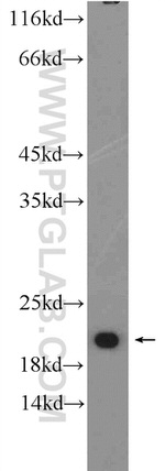 VPS25 Antibody in Western Blot (WB)