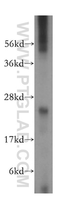 ARD1B Antibody in Western Blot (WB)