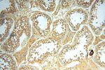 PPIL3 Antibody in Immunohistochemistry (Paraffin) (IHC (P))