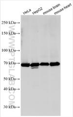 Collagen Type XXVII Antibody in Western Blot (WB)