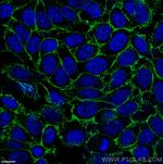 CD44 Antibody in Immunocytochemistry (ICC/IF)