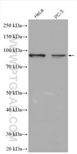LZTS2 Antibody in Western Blot (WB)