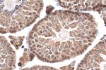 CDC45L Antibody in Immunohistochemistry (Paraffin) (IHC (P))
