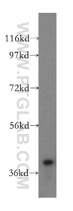 DLK2 Antibody in Western Blot (WB)