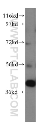 DLK2 Antibody in Western Blot (WB)