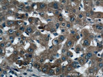 KHK Antibody in Immunohistochemistry (Paraffin) (IHC (P))