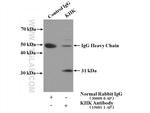 KHK Antibody in Immunoprecipitation (IP)
