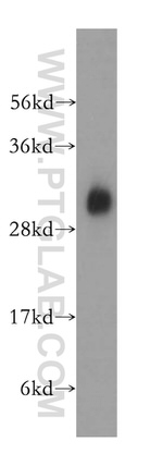 KHK Antibody in Western Blot (WB)