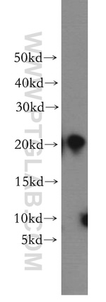 UBE2H Antibody in Western Blot (WB)
