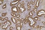 ERCC6L Antibody in Immunohistochemistry (Paraffin) (IHC (P))