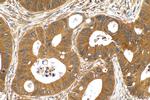 ERCC6L Antibody in Immunohistochemistry (Paraffin) (IHC (P))
