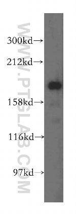 ERCC6L Antibody in Western Blot (WB)