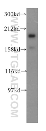 ERCC6L Antibody in Western Blot (WB)