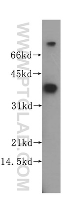 STARD7 Antibody in Western Blot (WB)