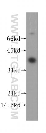 STARD7 Antibody in Western Blot (WB)
