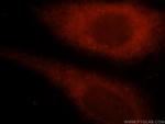TK1 Antibody in Immunocytochemistry (ICC/IF)