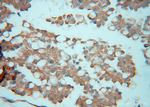 ATXN10 Antibody in Immunohistochemistry (Paraffin) (IHC (P))