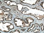MAP1S Antibody in Immunohistochemistry (Paraffin) (IHC (P))