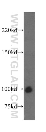 MAP1S Antibody in Western Blot (WB)