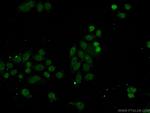 SSRP1 Antibody in Immunocytochemistry (ICC/IF)