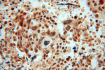 SSRP1 Antibody in Immunohistochemistry (Paraffin) (IHC (P))
