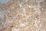 SSRP1 Antibody in Immunohistochemistry (Paraffin) (IHC (P))