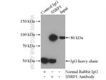 SSRP1 Antibody in Immunoprecipitation (IP)