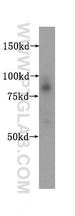 SSRP1 Antibody in Western Blot (WB)