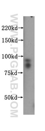 SSRP1 Antibody in Western Blot (WB)