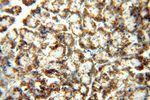 CLPP Antibody in Immunohistochemistry (Paraffin) (IHC (P))