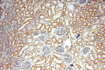 CLPP Antibody in Immunohistochemistry (Paraffin) (IHC (P))