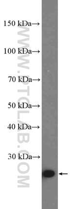 CLPP Antibody in Western Blot (WB)