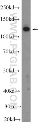 NOL6 Antibody in Western Blot (WB)