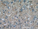 L2HGDH Antibody in Immunohistochemistry (Paraffin) (IHC (P))