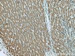 L2HGDH Antibody in Immunohistochemistry (Paraffin) (IHC (P))