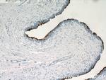 UPK3B Antibody in Immunohistochemistry (Paraffin) (IHC (P))