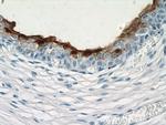 UPK3B Antibody in Immunohistochemistry (Paraffin) (IHC (P))