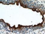 UPK3B Antibody in Immunohistochemistry (Paraffin) (IHC (P))