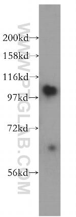 AMPD2 Antibody in Western Blot (WB)