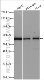 PIP5K1A Antibody in Western Blot (WB)