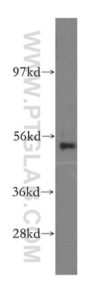 NARS2 Antibody in Western Blot (WB)