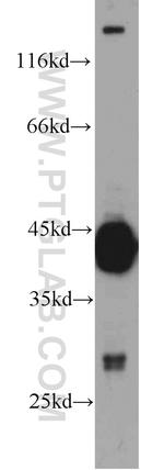 RIMBP2 Antibody in Western Blot (WB)
