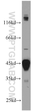 RIMBP2 Antibody in Western Blot (WB)