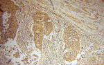 GLYATL1 Antibody in Immunohistochemistry (Paraffin) (IHC (P))