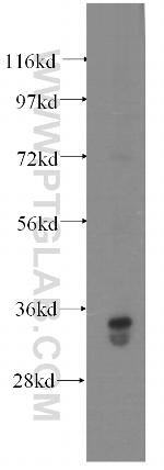 GLYATL1 Antibody in Western Blot (WB)