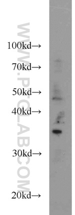 GLYATL1 Antibody in Western Blot (WB)