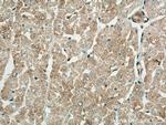 BCKDK Antibody in Immunohistochemistry (Paraffin) (IHC (P))