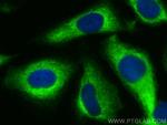 NMT2 Antibody in Immunocytochemistry (ICC/IF)