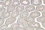 NMT2 Antibody in Immunohistochemistry (Paraffin) (IHC (P))
