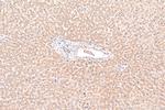 P3H2 Antibody in Immunohistochemistry (Paraffin) (IHC (P))